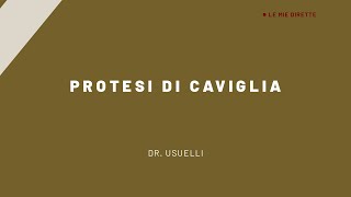 Protesi di caviglia [upl. by Ydnic889]