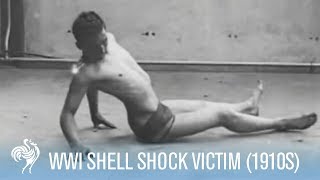 World War 1 Shell Shock Victim Recovery 1910s  War Archives [upl. by Adnawyek]