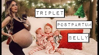 TRIPLET POSTPARTUM BELLY  CARAS POST PREGNANCY LIFE  CHATWIN SIBLING PAJAMA PARTY [upl. by Ahseenyt]