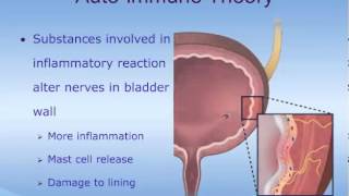 Understanding Interstitial Cystitis IC [upl. by Corrine]