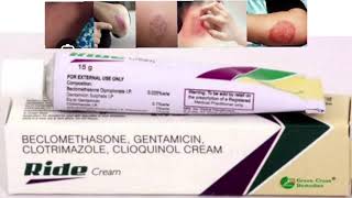 Ride Cream BECLOMETHASONE GENTAMICIN CLOTRIMAZOLE CLIOQUINOL CREAM [upl. by Udale396]