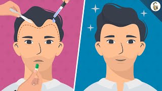 Hair Loss Treatments For Men According To Science [upl. by Yvel]