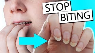 15 WAYS TO STOP BITING YOUR NAILS  Nailed It NZ [upl. by Werdnael628]