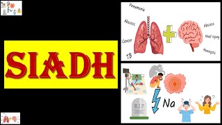 Syndrome of Inappropriate Secretion of Antidiuretic Hormone SIADH  SIADH [upl. by Spalla800]