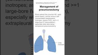 Management of pneumonectomy [upl. by Harimas850]