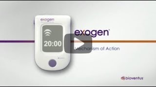 EXOGEN Mechanism of Action us [upl. by Afesoj258]