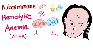 Autoimmune Hemolytic Anemia AIHA  Warm autoantibodies IgG  Hematology [upl. by Irtimed824]