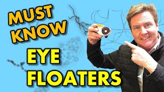 What your EYE DOCTOR hasnt TOLD you EYE FLOATERS EXPLAINED [upl. by Anitsihc987]