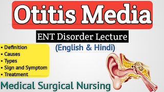 Otitis Media  Otitis Media In Hindi [upl. by Cathie809]