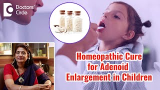 Adenoid Enlargement in Children amp Homeopathic Management  Dr Surekha Tiwari Doctors Circle [upl. by Ashwell]