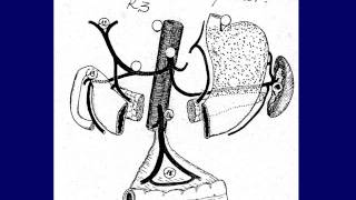 GASTROENTEROLOGIE cancer de lestomac 2 [upl. by Oinesra]