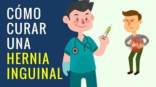 Cómo Curar Una Hernia Inguinal por Laparoscopia [upl. by Eimmij]