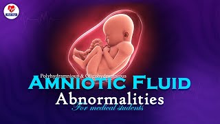 quotAmniotic Fluid AbnormalitiesUnveiling Obstetric Pathology and Key Clinical Insightsquot obgyn fmge [upl. by Milburr]