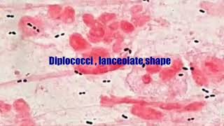 Gram stain of pneumococcus [upl. by Daub]