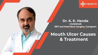 Mouth Ulcer Causes amp Treatment  Dr K K Handa  Medanta Gurugram [upl. by Elleinaj267]