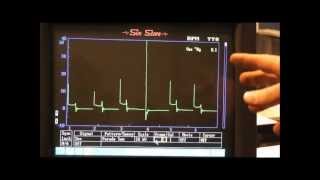 Secondary Ignition Waveforms common faults [upl. by Aruasi]