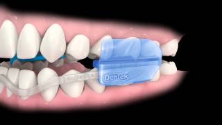 ComfortFit Dental Guard Instructions [upl. by Lenahtan287]