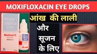 Moxifloxacin Eye Drops Hindi  Moxifloxacin And Dexamethasone Eye Drops [upl. by Lang]