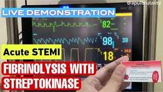 Fibrinolysis with streptokinase in acute STEMI  Cara fibrinolisis dengan streptokinase pada STEMI [upl. by Sorel]