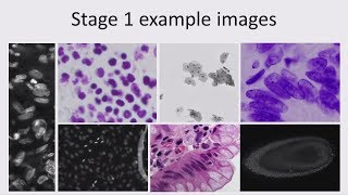 Kaggle Meetup Cell Nucleus Detection [upl. by Innos]