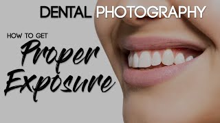 Dental Photography Basics  How to Take a Quality Dental Photo  Proper Exposure [upl. by Nylasoj]