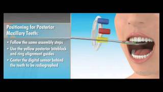 Dentsply Rinn XCPDS FIT Dentrek Module [upl. by Dorehs185]