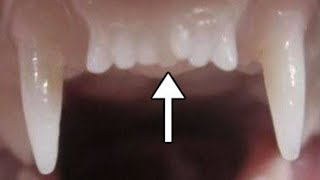 Worlds First Tooth Regrowing Drug Set To Start Human Trials [upl. by Faustine]