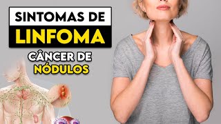 TOME CUIDADO Estes são os sinais e sintomas do LINFOMA │ Médico Explica [upl. by Yelda]