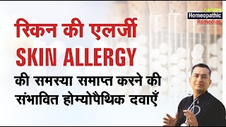 त्वचा की एलर्जी  SKIN ALLERGY  Homeopathic remedies with symptoms  होम्योपैथिक उपचार [upl. by Odlaniger]