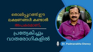 തൊലിപ്പുറത്ത് ഈ ലക്ഷണങ്ങൾ കണ്ടാൽ അപകടമാണ് പ്രത്യേകിച്ചും വാതരോഗികളിൽ [upl. by Yasnyl]