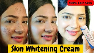 kojivit cream  kojivit gel  kojic acid cream  skin lightening cream  kozicare [upl. by Weinrich]