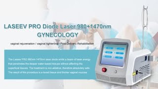 Vaginal laser therapy for gynecologic conditions Triangel TRB [upl. by Yllehs]