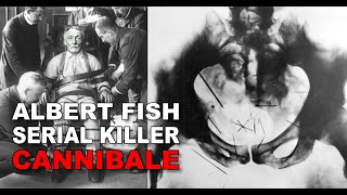 Albert Fish il SerialKiller cannibale che terrorizzò Brooklyn [upl. by January]