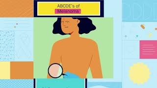 How to Detect Cancerous Moles The ABCDEs of Melanoma [upl. by Aicillyhp]