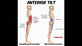 Anterior Pelvic Tilt Stretches BEST ONES TO DO [upl. by Ellatnahc]