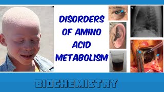 disorders of amino acid metabolism [upl. by Noiramed494]