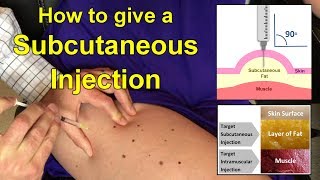 How to Give a Subcutaneous Injection Video [upl. by Dagny]