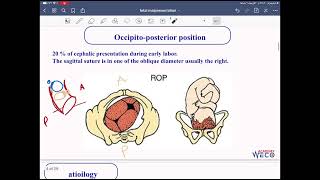 Obstetrics Fetal malpresentation 1 [upl. by Hagep]