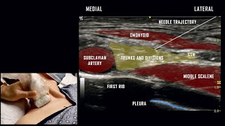 Supraclavicular Block  Ultrasound Anatomy Review [upl. by Attegroeg]