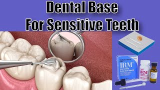 Dental Bases  Mixing and Placement  Dental Assisting 101 [upl. by Dietrich]