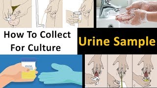 How to Collect Urine Sample For Culture [upl. by Enairb27]