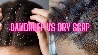 Dandruff vs Dry Scalp  Dandruff Treatments by Dr Shishira Dermatologist Evoluer Aesthetics Hyd [upl. by Atnahs755]