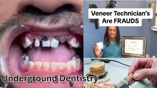 Exposed Veneer Techs Underground Dentistry Failures  Illegal and Dangerous [upl. by Perron]