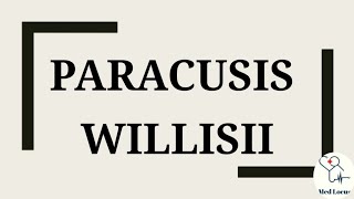 Paracusis Willisii [upl. by Duvall]