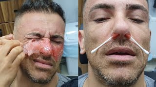 Amazing Waxing Eyebrow Full Face Waxing For Men [upl. by Aneehc]