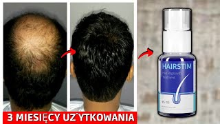 HairStim Opinie⚠️UWAGA Gdzie Kupić HairStimHairStim Recenzja w PolsceHairStim Spray Jak Stosować [upl. by Eila]