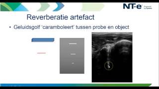 Webinar  Beeldfouten en artefacten in de echografie [upl. by Nauqad]