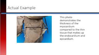 Phlebotomy Lesson 27 Layers of the Heart [upl. by Anyala]