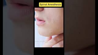 Spinal Anesthesia procedure trendingshortstrendingshortvideoshortfeedanesthesiaviral [upl. by Ssidnak708]