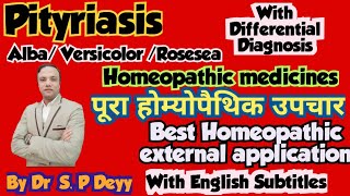 Pityriasis  सेहुआ  सफेद दाग  फीका दाग  Best Homeopathic Medicines [upl. by Bogoch]